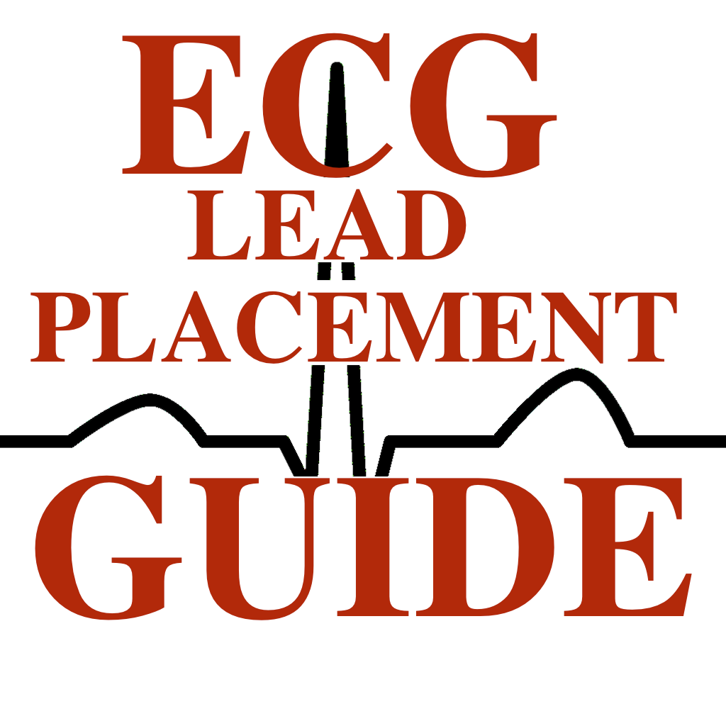 ECG/EKG Lead Placement Guide