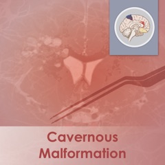 Cavernous Malformation