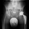 Symptoms - Besatree lyrics