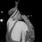 Hero 7 - MoFre$h lyrics