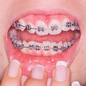 Teeth artwork