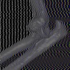 xiangyu - ひじのビリビリ