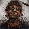 Craniotomy - Mr. Butcher