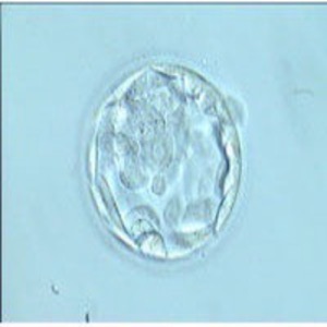 La Fecundación In Vitro (FIV)