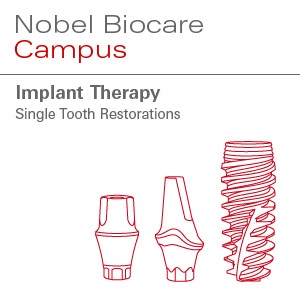 Implant Therapy: Single Tooth Restorations - Patient 2 cover