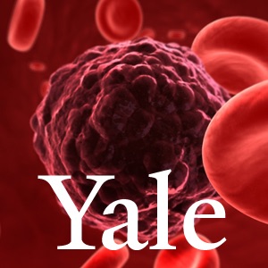 Yale Cancer Center Research