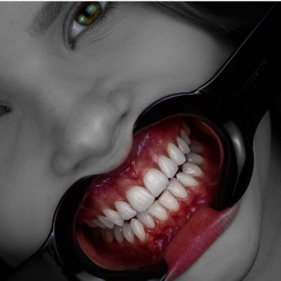 Dentcast Dentcast