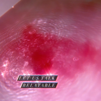 Let us talk Relatable