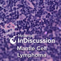 Medscape InDiscussion: Mantle Cell Lymphoma