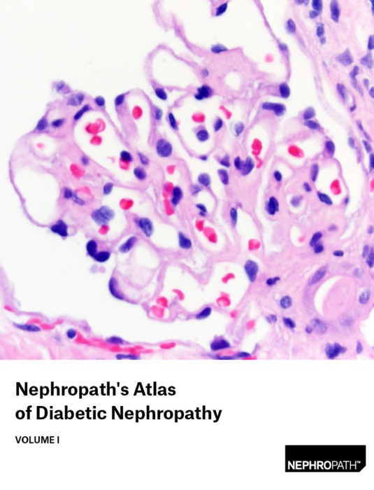 Nephropath's Atlas of Diabetic Nephropathy