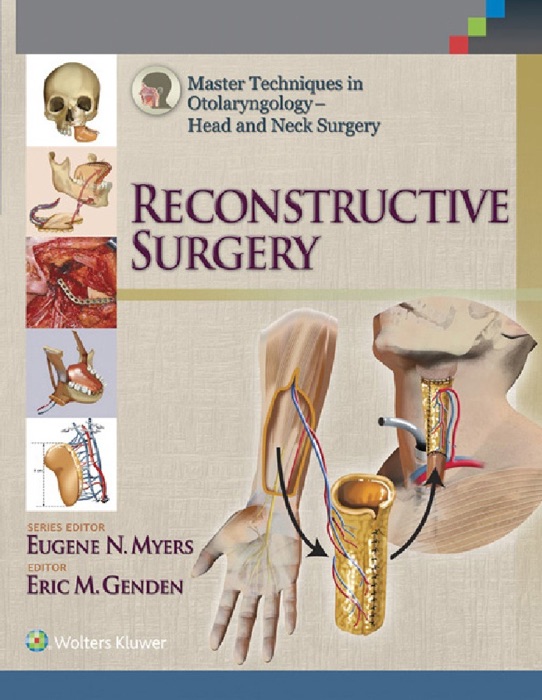 Master Techniques in Otolaryngology - Head and Neck Surgery: Reconstructive Surgery