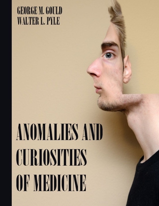 Anomalies and Curiosities of Medicine (Illustrated)