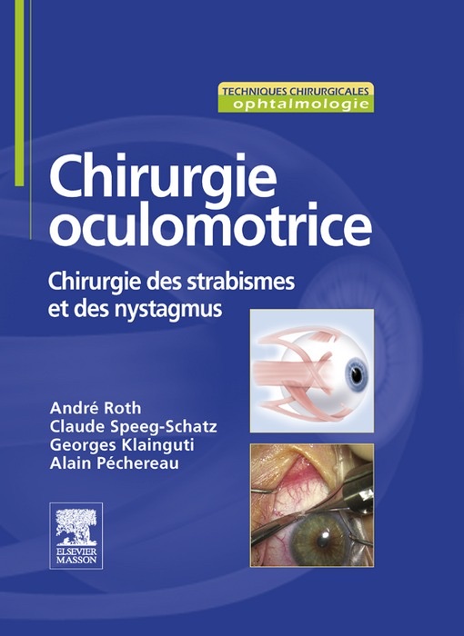 Chirurgie oculomotrice