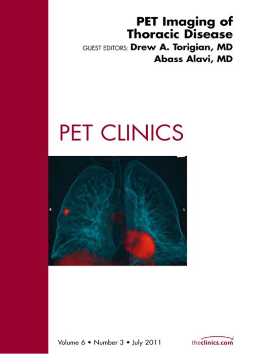 PET Imaging of Thoracic Disease,  An Issue of PET Clinics - E-Book