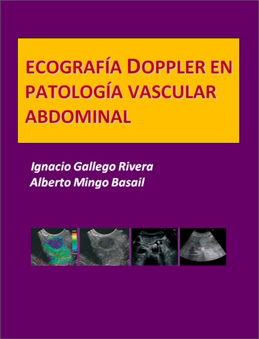 Ecografía Doppler en Patología vascular abdominal