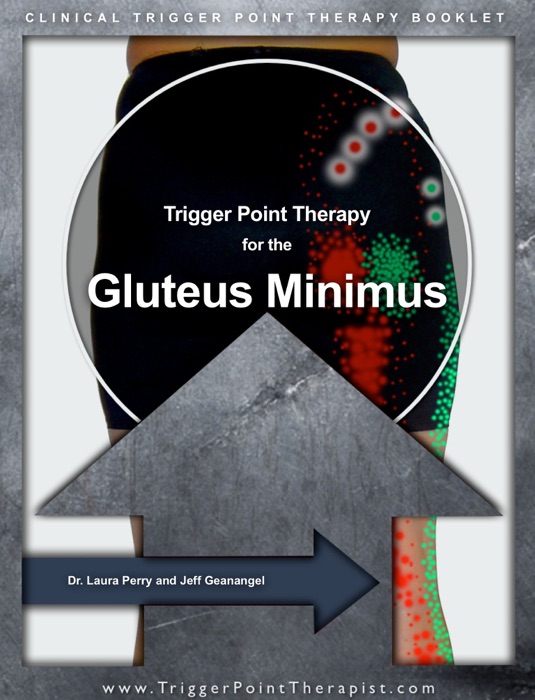 Trigger Point Therapy for the Gluteus Minimus