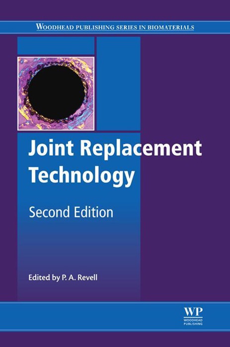 Joint Replacement Technology