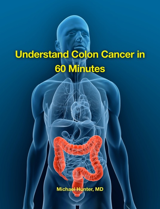 Understand Colon Cancer in 60 Minutes