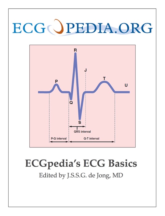 ECGpedia's ECG Basics