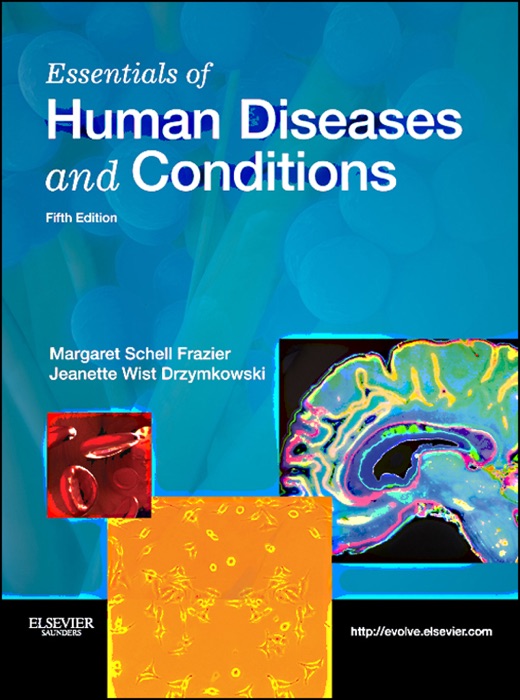 Essentials of Human Diseases and Conditions