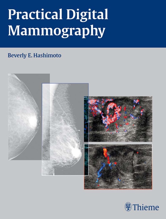 Practical Digital Mammography