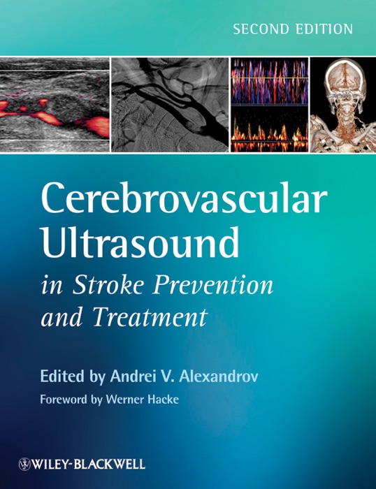 Cerebrovascular Ultrasound in Stroke Prevention and Treatment