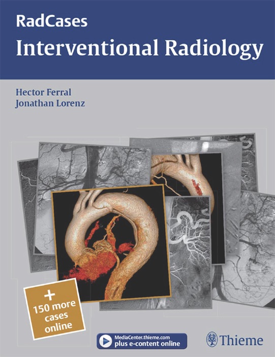 Interventional Radiology