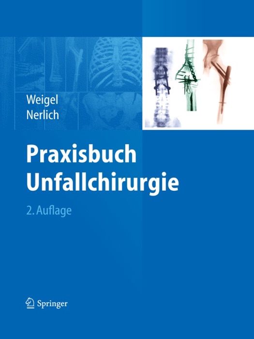 Praxisbuch Unfallchirurgie