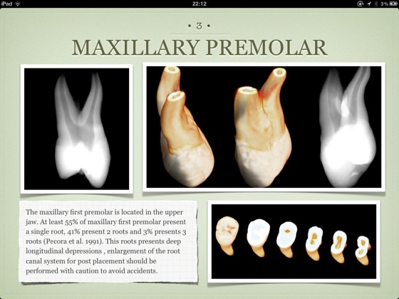 ‎The Internal Anatomy of Human Teeth. Atlas - Lite Version.1 on Apple Books