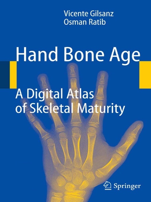 Hand Bone Age