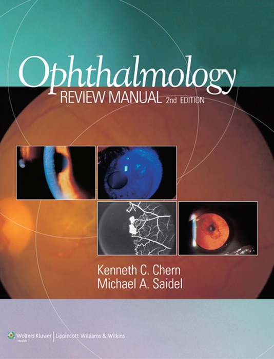 Ophthalmology Review Manual: 2nd Edition