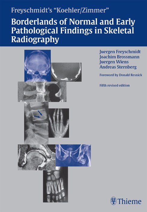 Koehler/Zimmer's Borderlands of Normal and Early Pathological Findings in Skeletal Radiography