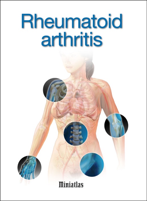 Rheumatoid Arthritis Miniatlas