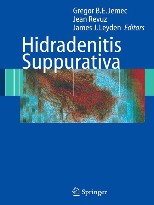 Hidradenitis Suppurativa