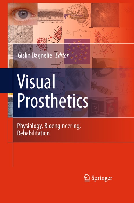 Visual Prosthetics