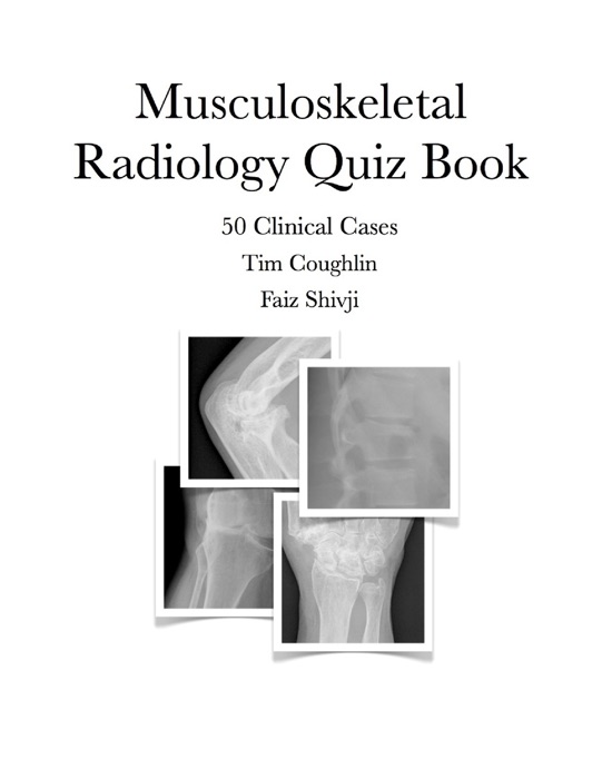 Musculoskeletal Radiology Quiz Book