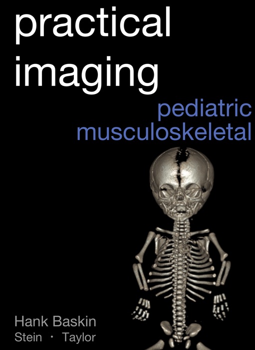 Practical Pediatric Musculoskeletal Imaging