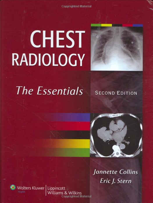 Chest Radiology: Second Edition