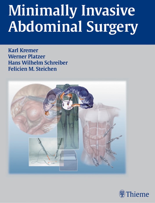 Minimally Invasive Abdominal Surgery