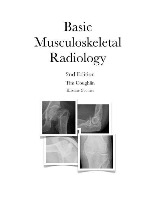 Basic Musculoskeletal Radiology