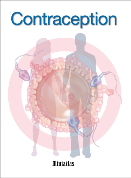 Contraception Miniatlas