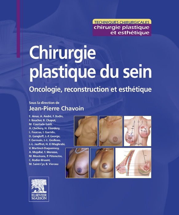 Chirurgie plastique du sein