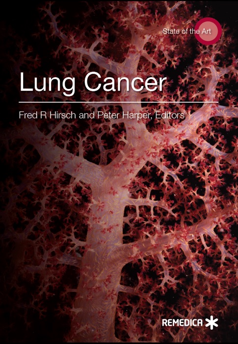 Lung Cancer: State of the Art