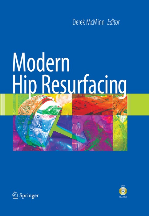 Modern Hip Resurfacing