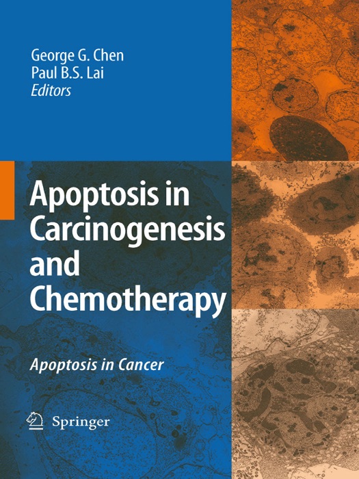 Apoptosis in Carcinogenesis and Chemotherapy