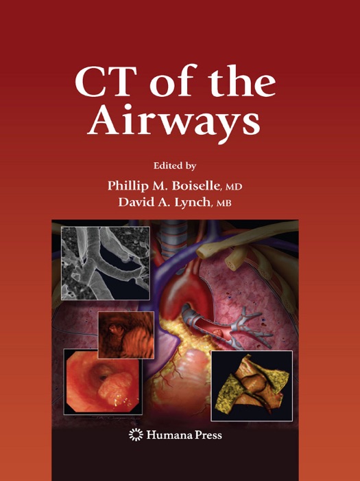 CT of the Airways