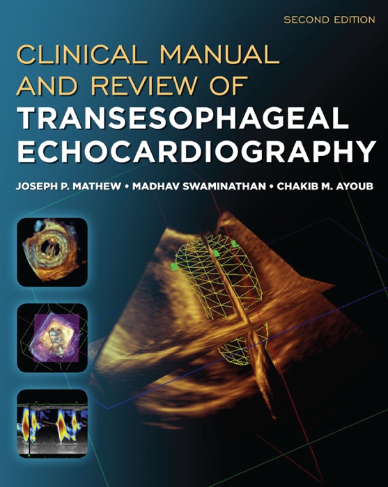 Clinical Manual and Review of Transesophageal Echocardiography, Second Edition