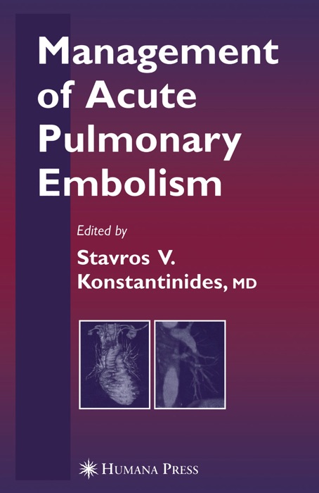 Management of Acute Pulmonary Embolism