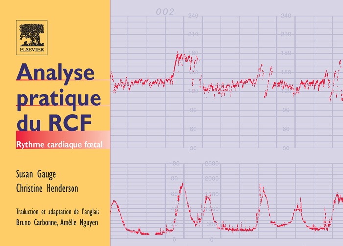 Analyse pratique du RCF