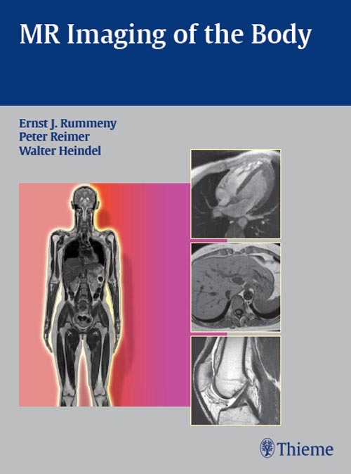 MR Imaging of the Body